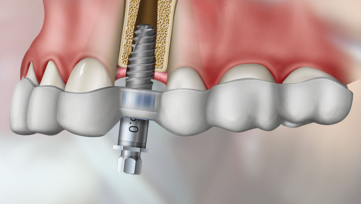 CIRURGIA-GUIADA2