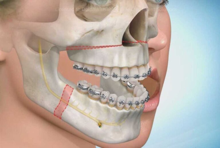 odontologia-e-implantes-ctbmf