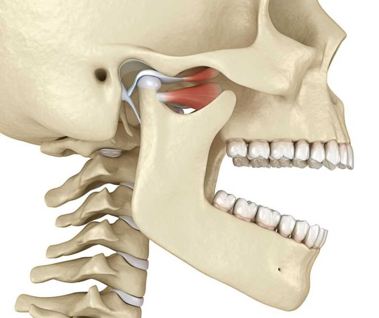 odontologia-e-implantes-disfuncao